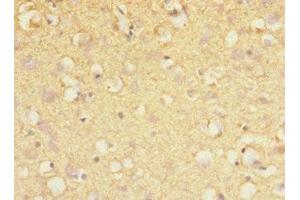 Immunohistochemistry of paraffin-embedded human brain tissue using ABIN7169067 at dilution of 1:100 (MARK1 anticorps  (AA 560-700))