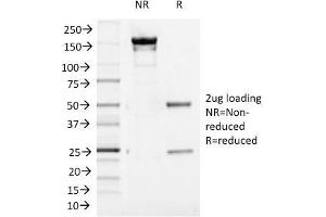 SDS-PAGE Analysis Purified Aurora B Mouse Monoclonal Antibody (AURKB/1521). (Aurora Kinase B anticorps  (AA 89-251))