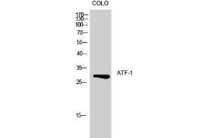 Western Blotting (WB) image for anti-Activating Transcription Factor 1 (AFT1) (Ser157) antibody (ABIN3173928) (AFT1 anticorps  (Ser157))