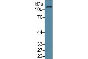 Western Blot; Sample: Human Lung lysate; Primary Ab: 1µg/ml Rabbit Anti-Human FAK Antibody Second Ab: 0. (FAK anticorps  (AA 798-1041))