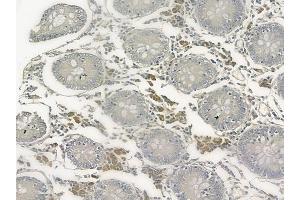 ABIN6257993 and ABIN6273660 at 1/100 staining human normal kidney tissue by IHC-P. (IL-6 Receptor anticorps  (N-Term))