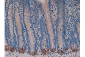 DAB staining on IHC-P; Samples: Rat Intestine Tissue