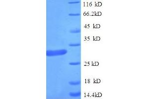 SDS-PAGE (SDS) image for Suppressor of Cytokine Signaling 1 (SOCS1) (AA 1-211), (full length) protein (His tag) (ABIN5710396)
