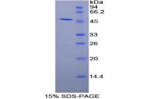 SDS-PAGE (SDS) image for Adiponectin Receptor 1 (ADIPOR1) (AA 1-136) protein (His tag,GST tag) (ABIN1169779)