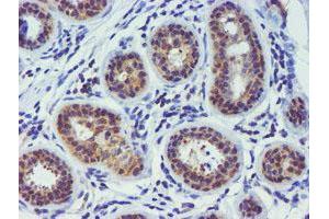 Immunohistochemical staining of paraffin-embedded Human breast tissue using anti-TIMP2 mouse monoclonal antibody. (TIMP2 anticorps)
