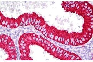 Anti-KRT18 / Cytokeratin 18 antibody IHC staining of human uterus, endometrium. (Cytokeratin 18 anticorps  (AA 381-430))