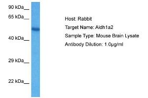 Host: Mouse Target Name: ALDH1A2 Sample Tissue: Mouse Brain Antibody Dilution: 1ug/ml (ALDH1A2 anticorps  (C-Term))