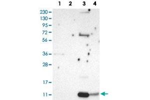 Western Blot analysis of Lane 1: RT-4 cell, Lane 2: U-251 MG sp cell, Lane 3: human plasma tissue (IgG/HSA depleted) and Lane 4: human liver tissue lysates with PPBP polyclonal antibody . (CXCL7 anticorps)