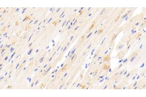 Detection of TIMP4 in Human Cardiac Muscle Tissue using Polyclonal Antibody to Tissue Inhibitors Of Metalloproteinase 4 (TIMP4) (TIMP4 anticorps  (AA 32-224))