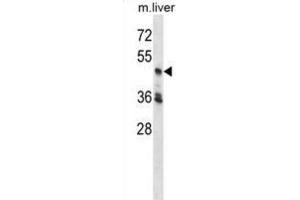 Western Blotting (WB) image for anti-Cyclin-Dependent Kinase 18 (CDK18) antibody (ABIN2998367) (CDK18 anticorps)
