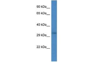 Host:  Rabbit  Target Name:  RRM2B  Sample Type:  293T Whole cell lysates  Antibody Dilution:  1. (RRM2B anticorps  (Middle Region))