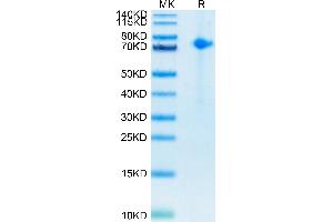 Biotinylated Human Notch 1 on Tris-Bis PAGE under reduced conditions.