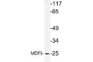 Western blot (WB) analysis of MDFI antibody in extracts from Jurkat cells. (MDFI anticorps)