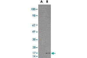 HEK293 overexpressing SH2D1A and probed with SH2D1A polyclonal antibody  (mock transfection in first lane), tested by Origene.