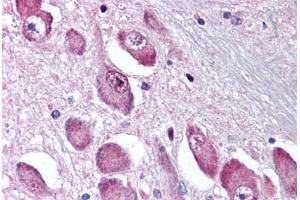 Anti-GABRA3 antibody  ABIN1048639 IHC staining of human brain, basal nucleus of Meynert.