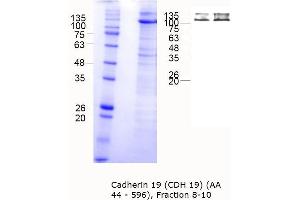 Western Blotting (WB) image for Cadherin 19 (CDH19) (AA 44-596) protein (MBP tag) (ABIN3106579)