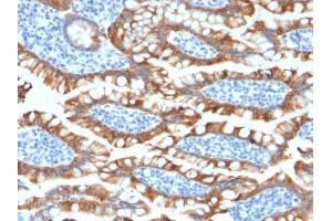 Formalin-fixed, paraffin-embedded human Small Intestine stained with Cytokeratin 8 Rabbit Recombinant Monoclonal Antibody (KRT8/2174R). (Recombinant KRT8 anticorps)