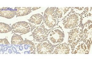 Immunohistochemistry of paraffin-embedded Mouse testis tissue using Smad4 Polyclonal Antibody at dilution of 1:200.