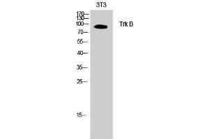 Western Blotting (WB) image for anti-Neurotrophic Tyrosine Kinase, Receptor, Type 2 (NTRK2) (Thr185) antibody (ABIN3187346)