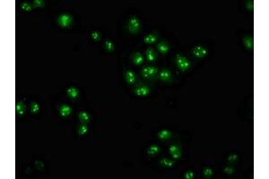 Immunofluorescence staining of Hela cells with ABIN7176203 at 1:100, counter-stained with DAPI. (ZNF268 anticorps  (AA 416-603))