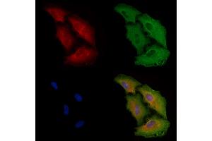 ABIN6261445 and ABIN6278454 staining  cells by IF/ICC. (EEF1B2 anticorps  (Internal Region))