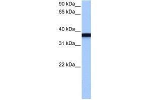 GSG1 antibody used at 1 ug/ml to detect target protein. (GSG1 anticorps  (C-Term))