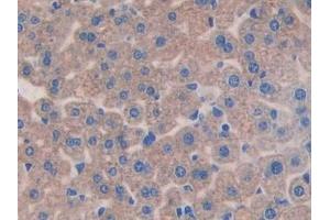 Detection of IL11Ra in Mouse Liver Tissue using Polyclonal Antibody to Interleukin 11 Receptor Alpha (IL11Ra) (IL11RA anticorps  (AA 59-217))