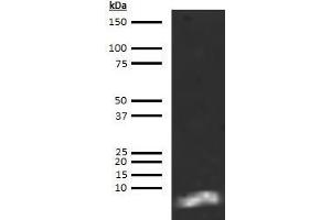 Western Blotting (WB) image for anti-Brain Natriuretic Peptide 45 (BNP-45) antibody (Biotin) (ABIN613019) (BNP-45 anticorps  (Biotin))