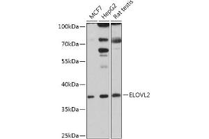 Western blot analysis of extracts of various cell lines, using ELOVL2 antibody (ABIN7266927) at 1:1000 dilution.