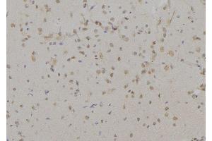 ABIN6277197 at 1/100 staining Mouse brain tissue by IHC-P. (Histone 3 anticorps  (H3K9me3))