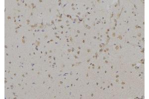 ABIN6277197 at 1/100 staining Mouse brain tissue by IHC-P.