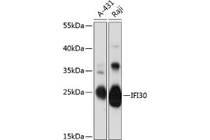 Western blot analysis of extracts of various cell lines, using IFI30 antibody (ABIN6131997, ABIN6142166, ABIN6142167 and ABIN6216814) at 1:3000 dilution. (IFI30 anticorps  (AA 1-250))