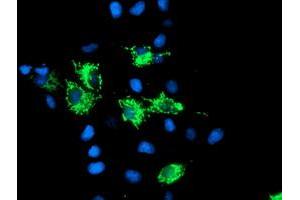 Anti-SIRT5 mouse monoclonal antibody (ABIN2454823) immunofluorescent staining of COS7 cells transiently transfected by pCMV6-ENTRY SIRT5 (RC200189). (SIRT5 anticorps)