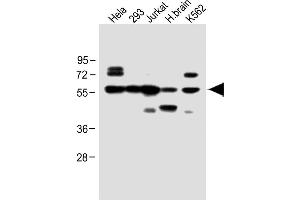 All lanes : Anti-IFNAR1 Antibody (Center) at 1:1000 dilution Lane 1: Hela whole cell lysate Lane 2: 293 whole cell lysate Lane 3: Jurkat whole cell lysate Lane 4: H. (IFNAR1 anticorps  (AA 162-188))