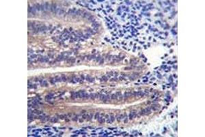 ANGPTL7 antibody immunohistochemistry analysis in formalin fixed and paraffin embedded human uterus tissue.