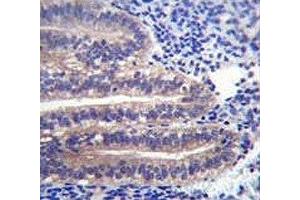 ANGPTL7 antibody immunohistochemistry analysis in formalin fixed and paraffin embedded human uterus tissue. (ANGPTL7 anticorps  (AA 300-350))