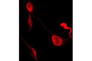 ABIN6278651 staining K562 by IF/ICC. (Ephrin B1/B2/B3 (pTyr324) anticorps)
