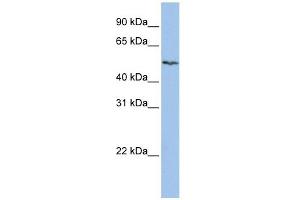 SLC16A6 antibody used at 1 ug/ml to detect target protein. (SLC16A6 anticorps)