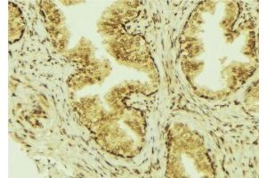 ABIN6277304 at 1/100 staining Mouse colon tissue by IHC-P.
