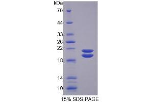 SDS-PAGE of Protein Standard from the Kit  (Highly purified E.
