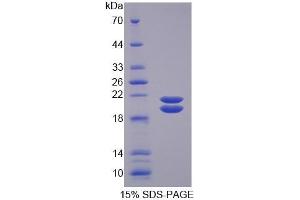 SDS-PAGE of Protein Standard from the Kit  (Highly purified E. (SFTPD Kit ELISA)
