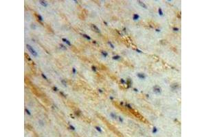 IHC-P analysis of Heart tissue, with DAB staining. (Corin anticorps  (AA 334-477))