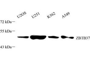 Western blot analysis of ZBTB37 (ABIN7076249) at dilution of 1: 2000 (ZBTB37 anticorps)