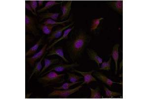 Image no. 2 for anti-Activating Transcription Factor 2 (ATF2) (Thr53), (Thr71) antibody (ABIN197148)