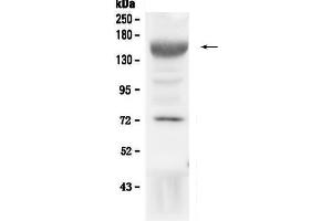Western blot analysis of IGF1 Receptor using anti-IGF1 Receptor antibody . (IGF1R anticorps  (AA 31-257))