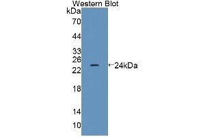 Western blot analysis of the recombinant protein. (ACADS anticorps  (AA 210-397))