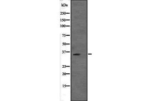 Western blot analysis of VGLL2 expression in VGLL2 transfected 293T cell lysate,The lane on the left is treated with the antigen-specific peptide. (VGLL2 anticorps  (Internal Region))
