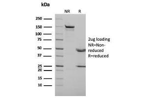 SDS-PAGE Analysis Purified p73 Mouse Monoclonal Antibody (P73/2531). (Tumor Protein p73 anticorps)