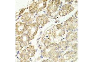Immunohistochemistry of paraffin-embedded Human gastric using CTNND1 antibody at dilution of 1:100 (x400 lens). (CTNND1 anticorps  (AA 573-832))