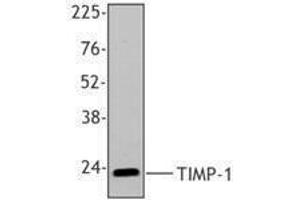 Western Blotting (WB) image for anti-TIMP Metallopeptidase Inhibitor 1 (TIMP1) antibody (ABIN2666373) (TIMP1 anticorps)